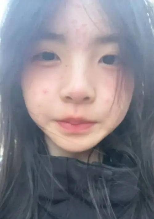 “这种满脸痘的最迷人了”，高中女生素颜走红，让男生3年忘不了
